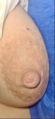 Mamilos